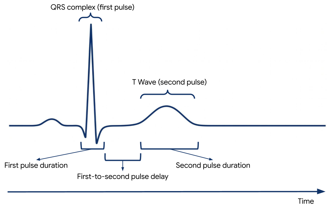 แปลงส่วนของ ECG และรูปคลื่นลักษณะเฉพาะ